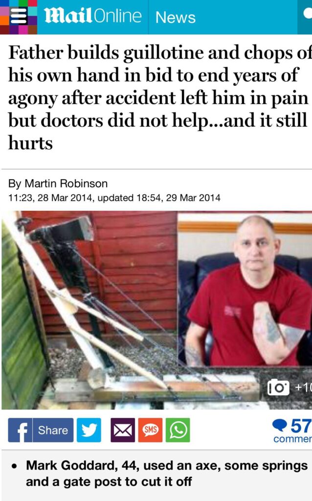 Man with fibromyalgia who cut off his own hand