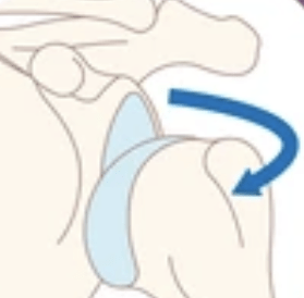 a Subluxated shoulder