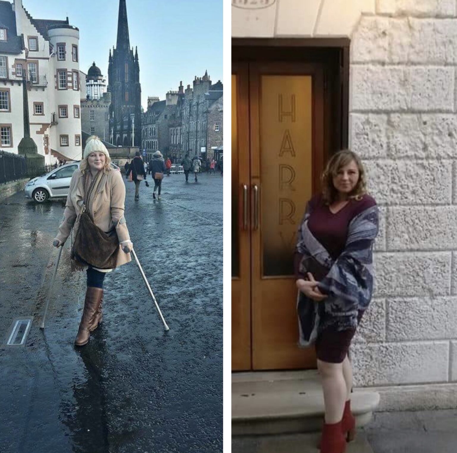 A before and after picture of a woman getting off crutches