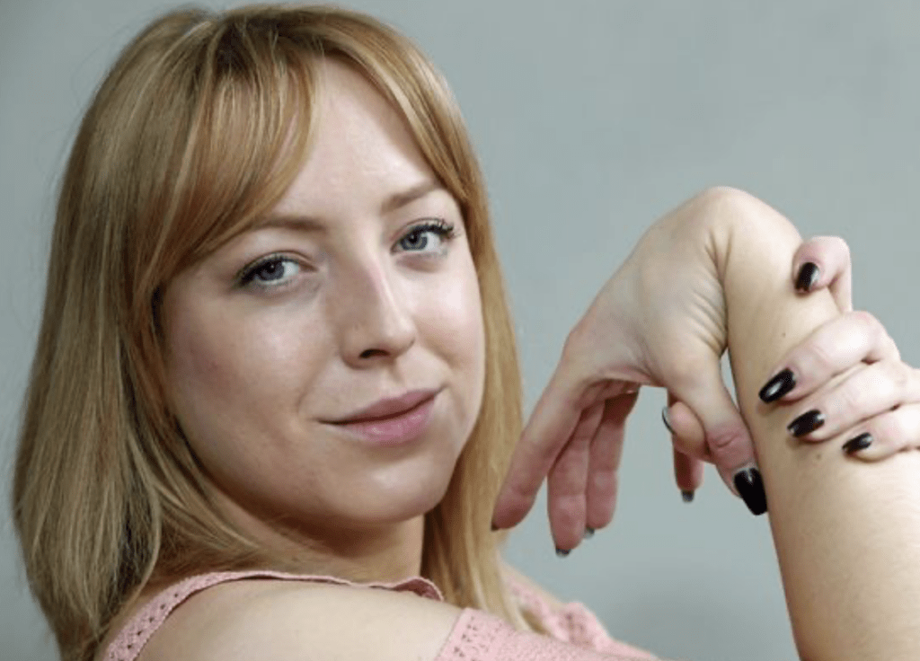 A woman bending her hypermobile wrist