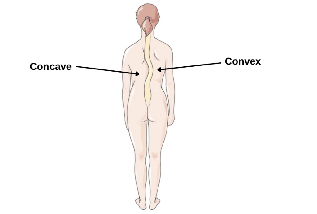 Illustration adapted from Servier Medical Art under CC BY 4.0. Modified to label convex and concave sides