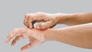 a man scratching his hand