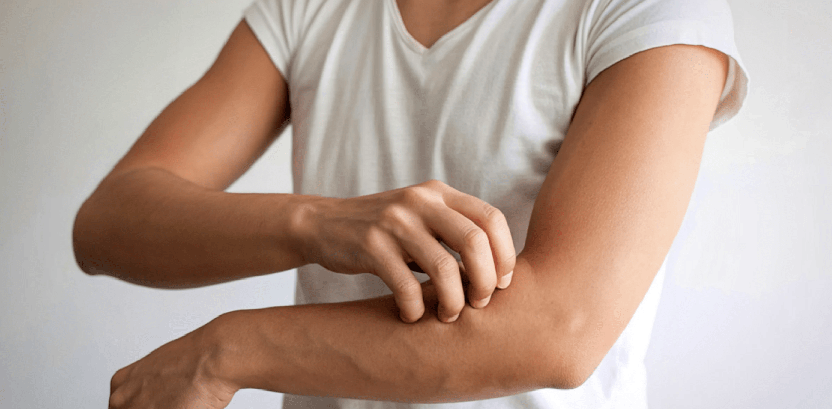 A woman with fibromyalgia, wearing a white t shirt, itching her arm