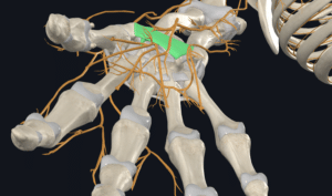 The carpal tunnel seen from the palm side, with the transverse carpal ligament highlighted in green roofing over the wrist bones, and the nerves of the hand shown in orange.